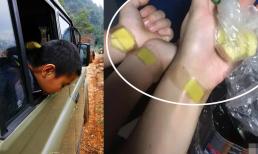 Tôi nên làm gì nếu bị say xe hoặc say sóng? Dạy bạn 5 mẹo tạm biệt say tàu xe, say sóng mà không cần dùng thuốc