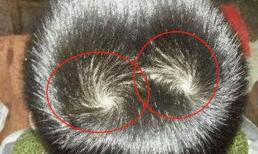 'Vòng xoáy' trên đầu đứa trẻ có ý nghĩa gì? Nó có liên quan đến IQ và tính cách không? Sự thật khoa học giải thích