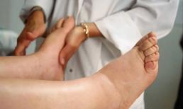 Bác sĩ cảnh báo: Nếu có 3 dấu hiệu này ở chân nghĩa là bạn sắp đột tử không xa, hãy nhanh chóng đi khám