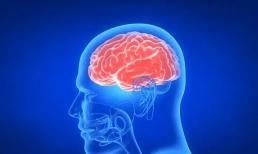 Nếu phát hiện teo não thì có phải là bệnh Alzheimer? Các triệu chứng của teo não là gì?