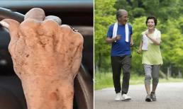 Bác sĩ: Người có tuổi thọ cao thường có những đặc điểm này!