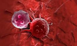 Tại sao người Mỹ có tỷ lệ ung thư rất thấp? Đây là cách mà người Mỹ đã ngăn ngừa ung thư 