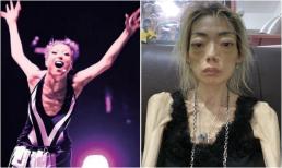 Dưới filter nhìn rất xinh đẹp nhưng ngoài đời lại là 'ma nữ'! Những sao nữ nổi tiếng gầy ốm bệnh tật này khiến dân tình rùng mình