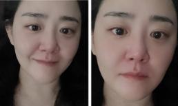 'Em gái quốc dân' Moon Geun Young gây hoang mang khi đăng hình đôi mắt đẫm lệ, chuyện gì đã xảy ra với cô? 