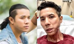 Hình ảnh mới nhất của Kasim Hoàng Vũ: Tiều tuỵ xơ xác đến đau lòng