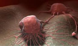 Tại sao không thể phát hiện được ung thư ngay cả sau khi khám sức khỏe hàng năm? Nhắc nhở: Khám sức khỏe, phải hoàn thành 7 bài kiểm tra này 