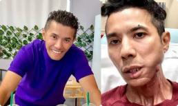 Tình hình sức khỏe hiện tại của Kasim Hoàng Vũ: Mệt do truyền thuốc kháng sinh và giảm đau mỗi ngày