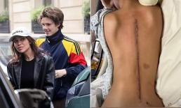 Bạn gái mới của Cruz Beckham gây sốc khi tiết lộ vết sẹo dài dọc sống lưng, thái độ con trai David mới đang chú ý