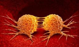 Nửa năm trước khi mắc bệnh ưng thư, cơ thể sẽ gửi 6 'tín hiệu' này