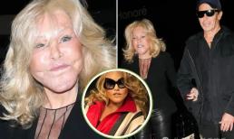 Là trường hợp phẫu thuật thẩm mỹ thất bại nhất thế giới, giờ cô lại được bạn trai kém mình 27 tuổi yêu