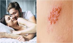 Làm sao để xác định bạn tình có mắc bệnh lây truyền qua đường tình dục trước khi quan hệ? 2 phương pháp mà cả nam và nữ đều nên biết