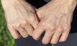 Nhìn vào mu bàn tay có thể biết một người sống được bao lâu? Những người có tuổi thọ cao thường có 4 dấu hiệu này ở mu bàn tay