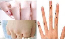 Nếu bạn có nốt ruồi này trên tay, phúc lộc và trường thọ sẽ theo bạn