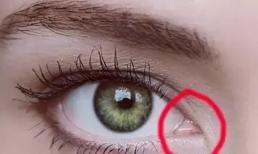 6 bộ phận của nhân loại có thể biến mất trong tương lai, mỗi bộ phận đều không có ích gì với nhân loại