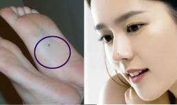 6 nốt ruồi báo hiệu giàu sang và phúc lộc trên người phụ nữ, được một cũng đã là điều hiếm có