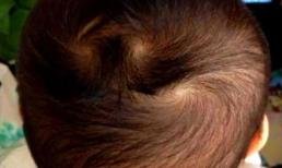 Trẻ có 'xoay tóc' trên đầu càng nhiều càng thông minh? Đây là câu trả lời khác với tưởng tượng