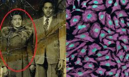 Người phụ nữ này chỉ sống 31 tuổi nhưng tế bào của cô bất tử và đã cứu sống hàng trăm triệu người