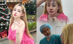 Tại sao Ngân 98 quyết tâm sửa mũi lần thứ 12?