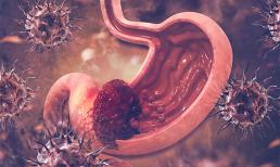 90% bệnh ung thư dạ dày khi được phát hiện là ở giai đoạn giữa và cuối! 4 triệu chứng sau bữa ăn là điềm báo, cần sớm đi nội soi