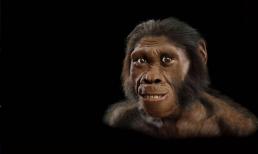 Tại sao con người lại tiến hóa thành lông hậu môn? Hậu quả của việc cạo nó đi là gì?