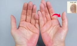 Giàu sang hay nghèo khó, chỉ cần xòe bàn tay, nhìn ngón cái là biết ngay