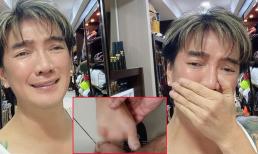 Đàm Vĩnh Hưng mất hết 4 ngón chân trong vụ tai nạn ở nhà tỷ phú Mỹ?