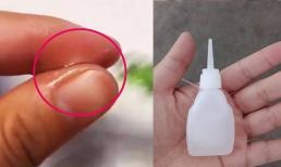 Tôi phải làm gì nếu keo dính vào tay? Dạy bạn một giải pháp hoàn hảo