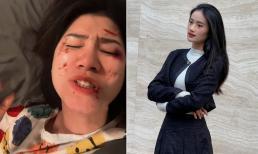 Sao Việt 14/2: Trang Trần lộ mặt bầm dập? Ảnh mới của Hoa hậu Ý Nhi khiến fans lo lắng