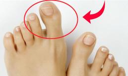 Sau 30 tuổi, tiền tài ùn ùn kéo đến nếu bạn có 4 tướng bàn chân 'thần tài' này, khám phá ngay vận mệnh của bạn