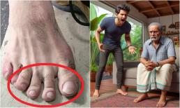 Có câu: 'Ngón chân thứ hai dài hơn ngón cái, lớn lên không hiếu thuận', thực hư câu nói này là gì?