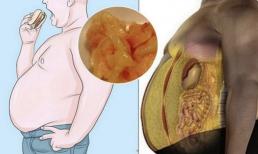 Cần làm gì sau bữa ăn để hạn chế tích tụ mỡ nội tạng