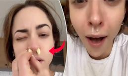 Nhiều người sẽ bất ngờ khi biết đặt một tép tỏi nhỏ vào lỗ mũi mang đến công dụng thần kỳ