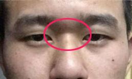 Người xưa đúc kết: Người có bốn tướng mạo này cả đời sẽ nghèo khó, không có tiền đồ, cần phải làm nhiều việc thiện để bù đắp