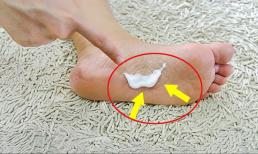 Tôi đã bôi kem đánh răng vào lòng bàn chân của chồng 5 ngày liên tiếp, hiệu quả thần kỳ khiến ai cũng bất ngờ, hãy thử ngay