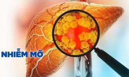 Khỏi hẳn gan nhiễm mỡ nhờ làm điều này mỗi ngày, bác sĩ nói: 'Rất đơn giản, không tốn tiền'