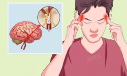 Nếu bạn cảm thấy tê ở 3 vị trí này trên cơ thể, đó chính là 'lời cảnh báo' cuối cùng của chứng nhồi máu não! Nhiều người không coi trọng điều đó