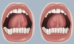 Bạn có thể rèn luyện não bộ bằng cách cử động lưỡi! Bác sĩ: Hãy thử 3 bài tập này, giúp làm chậm quá trình thoái hóa não
