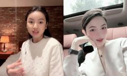 Chu Thanh Huyền lộ diện với gương mặt bầm tím, kể lại trải nghiệm đau đớn khi xử lý hậu quả của phẫu thuật thẩm mỹ