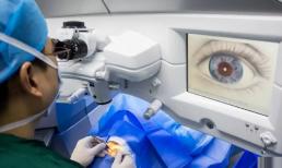 Phẫu thuật cận thị tốt như vậy, tại sao bác sĩ vẫn khuyên bạn không nên dễ dàng làm? 90% mọi người không biết sự thật