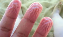 Tại sao ngón tay bị nhăn nheo khi ngâm nước lâu?