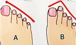 Trắc nghiệm tâm lý: Ngón chân của bạn thuộc nhóm máu A hay B? Bạn có thể biết mình là người hướng ngoại hay hướng nội không?