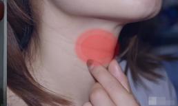  5 căn bệnh phổ biến này thực chất là 'tổn thương tiền ung thư', nhưng nhiều người không coi trọng chúng