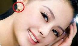 Thầy tướng số nói: Người có nốt ruồi ở đây, định mệnh giàu sang, tiền vào như nước, muốn nghèo cũng không nổi