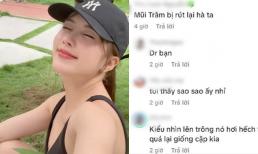 Thiều Bảo Trâm lên tiếng trước nghi vấn bị biến chứng hậu 'dao kéo'