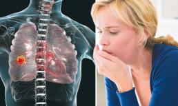 Thật kinh ngạc! 60% bệnh nhân ung thư phổi chưa từng hút thuốc, chuyên gia chỉ mặt 2 nhóm thực phẩm là sát thủ gây ung thư, nhiều người vẫn ăn hàng ngày