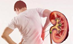 Cảnh báo: Một thói quen xấu mà nhiều người hay mắc phải, đặc biệt dân văn phòng, có thể gây suy thận, phải chạy thận cả đời
