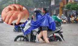 Lội nước mưa ngập úng về nhà cần làm ngay 9 điều để không bị ghẻ lở, bệnh ngoài da