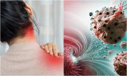 4 kiểu đau vai 'vạch trần' cả tá bệnh ung thư, không phải ai cũng để tâm, chớ vội đổ lỗi cho xương khớp