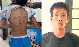 Vụ bé gái lớp 5 nghi bị bố dượng bạo hành: Có thêm loạt chi tiết gây phẫn nộ
