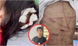 Cha dượng sẽ đối mặt với mức án nào khi dùng búa bạo hành con riêng 10 tuổi ở Hà Tĩnh?